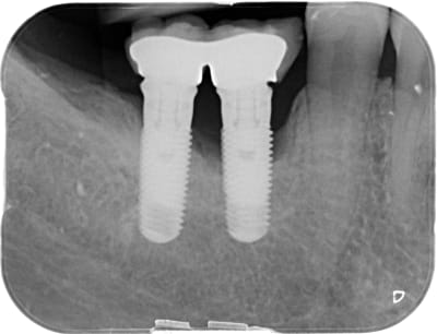Qgwmgpimvtgbibyakj2o - Eugenol