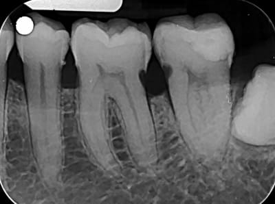 Qnlzwbaqr7glmyzf5si8 - Eugenol
