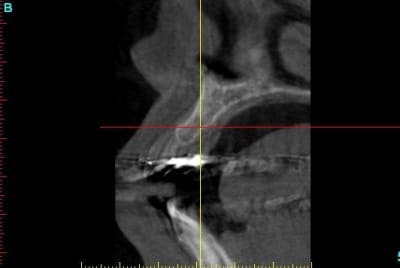 Quasimodo section12x bdppfq - Eugenol