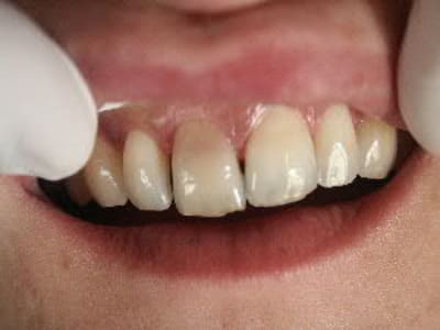 Quesnel fdseib - Eugenol