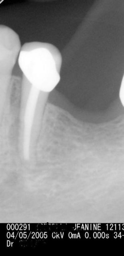 Quid us6aqf - Eugenol