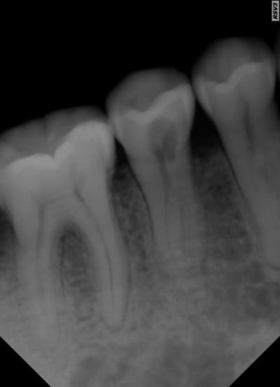 R tro otjpds - Eugenol