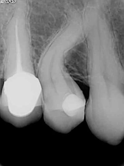Racine courbe oaqcl4 - Eugenol