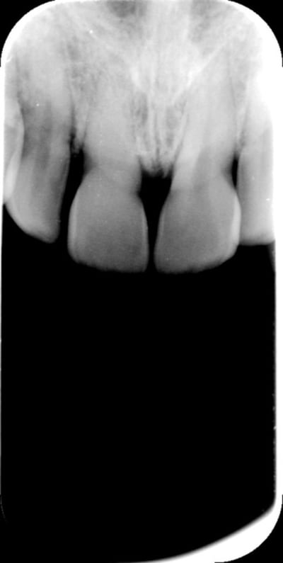 Rad quesn mheo8g - Eugenol