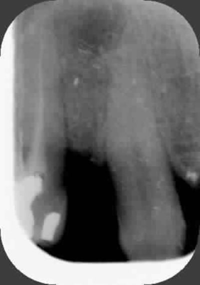 Radio13 vysmbk - Eugenol