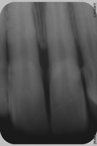 Radio3 gtjduw - Eugenol