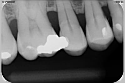 Radio 16 2009 alhcqr - Eugenol