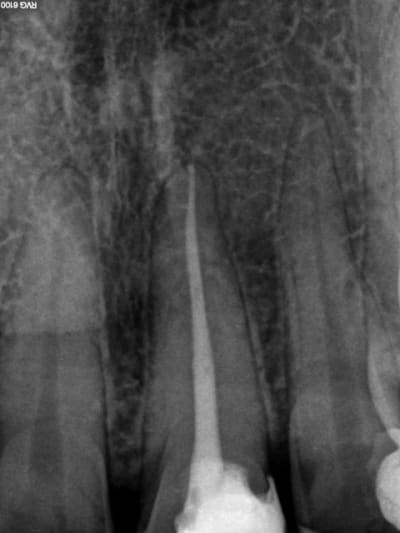 Radio cone scelle  ycyvv2 - Eugenol