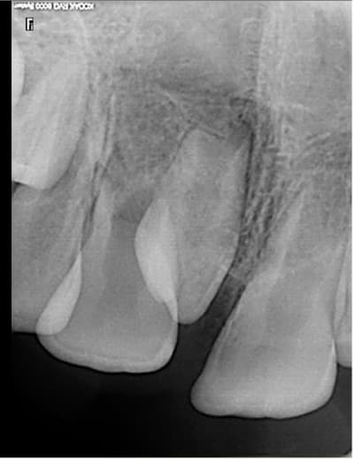 Radio jbgank - Eugenol