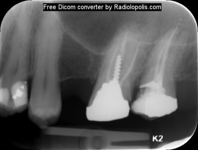 Radiolopolis 1 pqzmoo - Eugenol