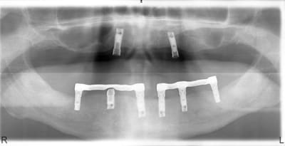 Ratti1 prdzzr - Eugenol