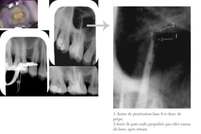 Recap zhoflv - Eugenol