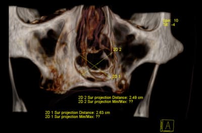 Recons2 ivvtqi - Eugenol