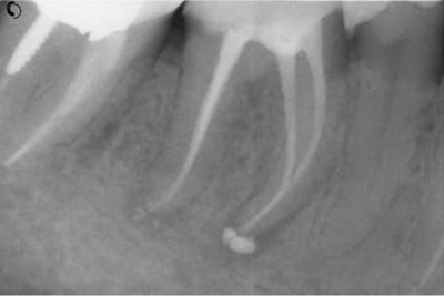 Reprise4cx uandde - Eugenol