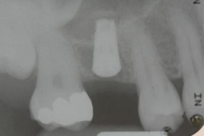 Retro apr s xuhlge - Eugenol