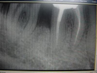 Retro0301 aj0l1f - Eugenol