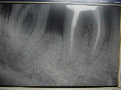 Retro0301 ydrh0o - Eugenol