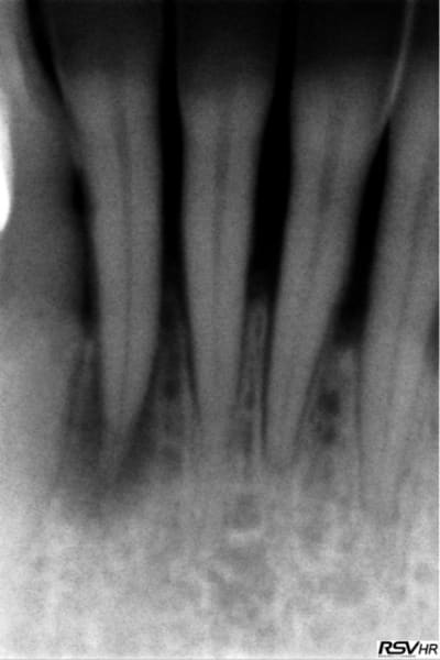 Retro0503 hjdunf - Eugenol