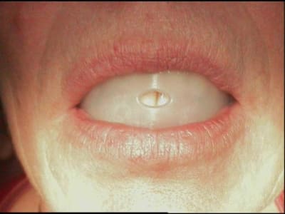 Rflmt 3 xajopn - Eugenol