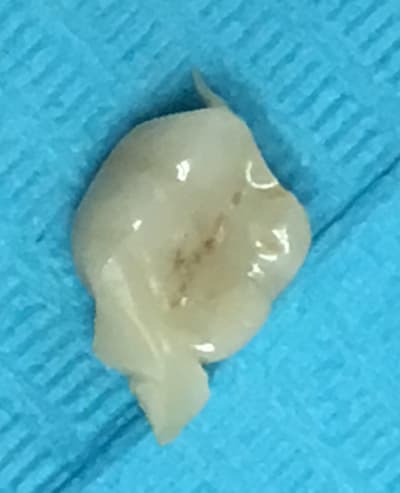 Rh56dk7mlvrhxpet38d2 - Eugenol