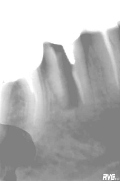 Rho izsog4 - Eugenol