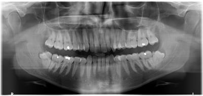 Rn8gapzcuxfpsvuhvbjl - Eugenol