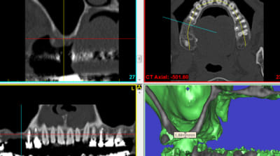 Ro5 zggn8g - Eugenol