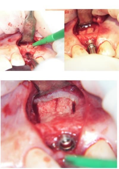 Rog2 txelsd - Eugenol