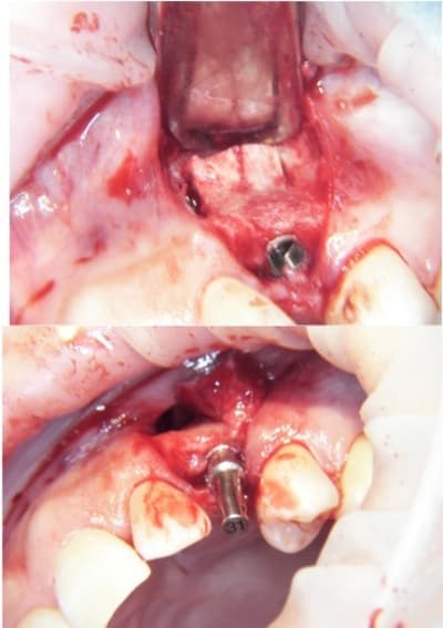 Rog4 jcyvl7 - Eugenol