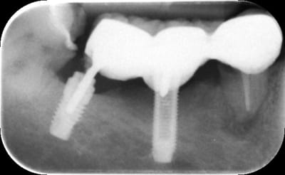 Rsjorovrp37ujaw50x1y - Eugenol