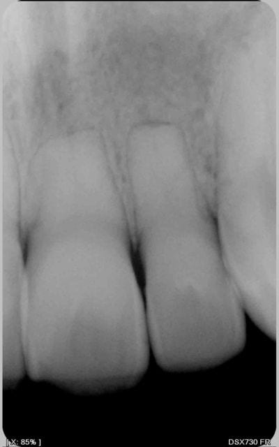 Rx2 d3wm5q - Eugenol