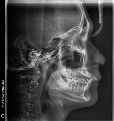 S1w7jnbis6fyctck8twqsq8c3d76 - Eugenol