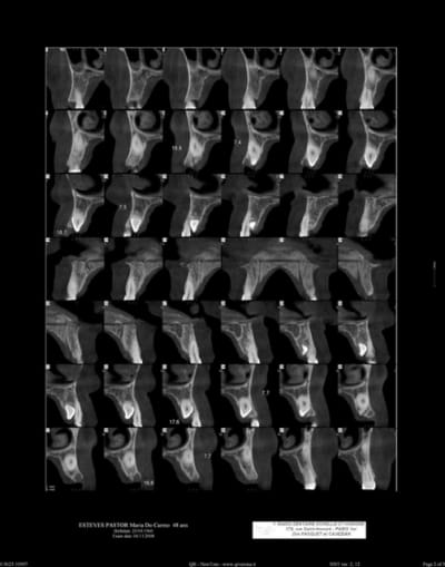 Sagittales  800x600  sfbq0a - Eugenol