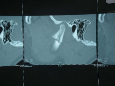 Scan1 utrv4k - Eugenol