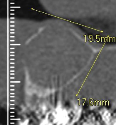 Scan profil entre 11 et 12 m91ppg - Eugenol
