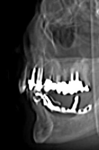 Scan profil l52uev - Eugenol