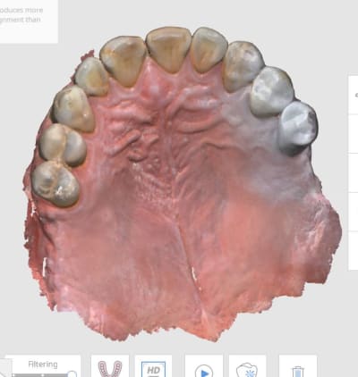 Scan sup pour stellite qeyofd - Eugenol
