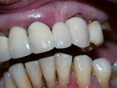 Secteur gauche f2ne3o - Eugenol