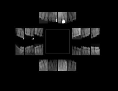 Signe d appel t2p7ym - Eugenol