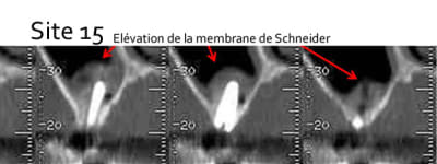 Site 15 a5j3mt - Eugenol