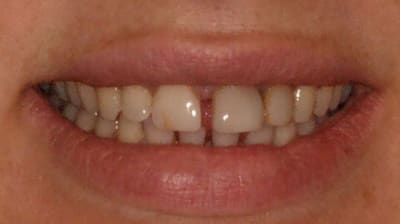 Smile dwqwwm - Eugenol