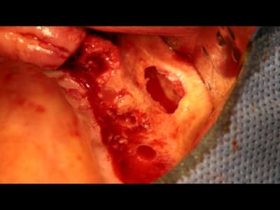 Snapshot2 jvip0h - Eugenol