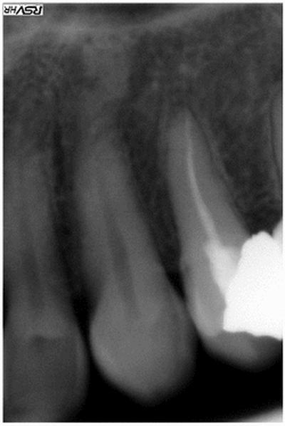 Soyons clair.. - Eugenol