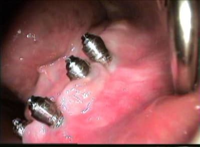 Suivi 3 fgb3eh - Eugenol