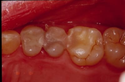 Systemp ishngx - Eugenol