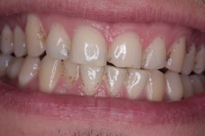 Taches  3   800x600  insbqt - Eugenol