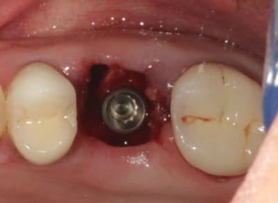 Test rsn4yo - Eugenol