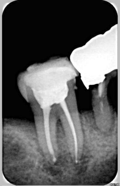 Touché yq8hio - Eugenol