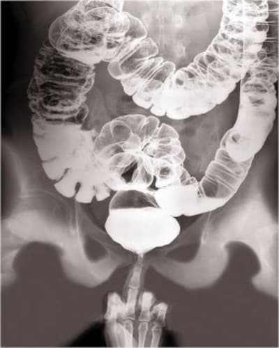 Tr ethscc - Eugenol