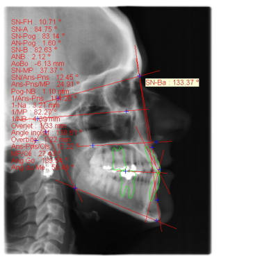 Trace le1ydj - Eugenol